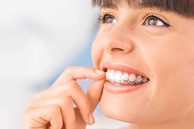 Invisalign in Fishers